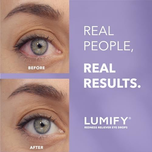 LUMIFY Redness Reliever Eye Drops, For Whiter & Brighter Looking Eyes, 0.08 Fl Oz (2.5 mL) - Image 3